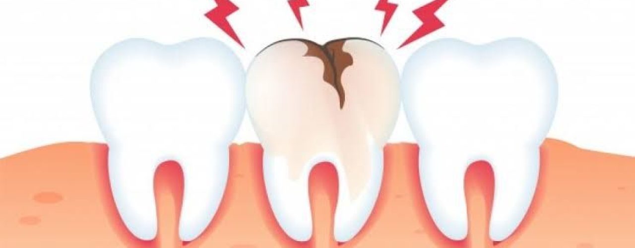 0c31fb2037053128b6604e548e106c9d